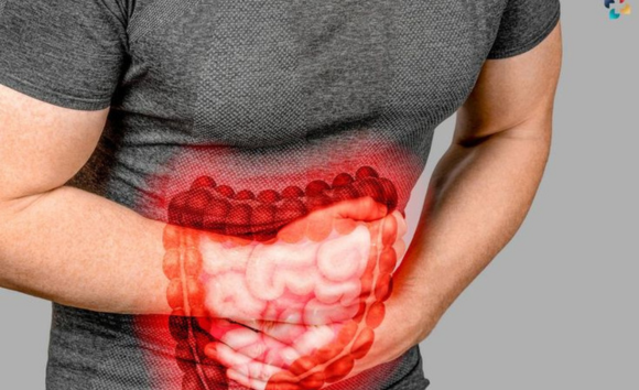 Phân biệt hội chứng ruột kích thích với bệnh lý tiêu hóa khác? 