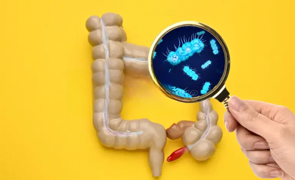 Vi khuẩn đường ruột và hội chứng ruột kích thích 