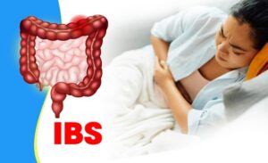 FTT_Đâu do hội chứng ruột kích thích thường ở vị trí nào?