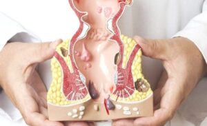 FTT_Đau hậu môn khi đi ngoài có nguy hiểm không
