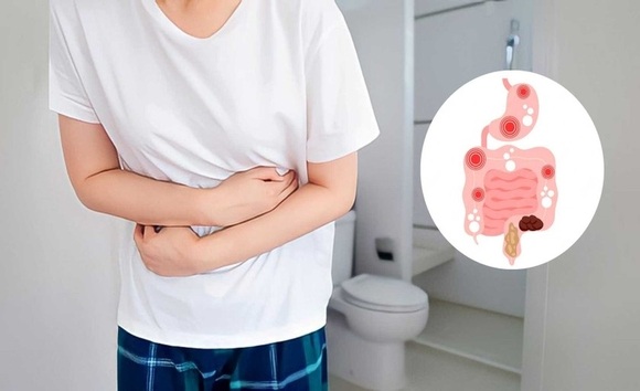 Hội chứng ruột kích thích có tự chữa khỏi tại nhà được không? 