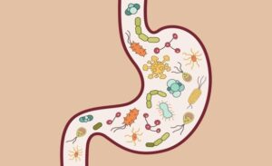 FTT_Viêm ruột mãn tính tái phát liên tục