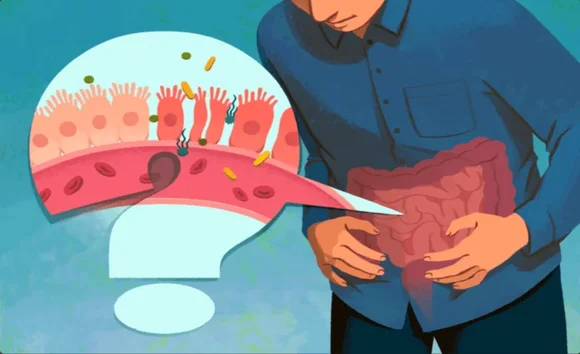 Rò rỉ ruột – “thủ phạm thầm lặng” gây rối loạn tiêu hóa và miễn dịch 
