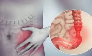 FTT_ Đau bụng dưới bên trái