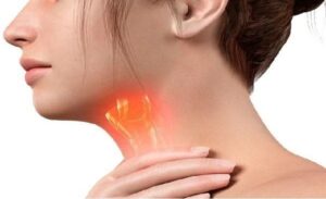 FTT_Triệu chứng vướng cổ họng