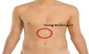 FTT_Thường xuyên đau thượng vị sau ăn