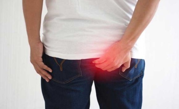 Viêm đại tràng có dẫn đến trĩ không? Câu trả lời từ góc nhìn y khoa 