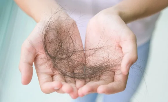 Nhịn ăn cơm trắng có gây rụng tóc không? Sự thật ít người biết 