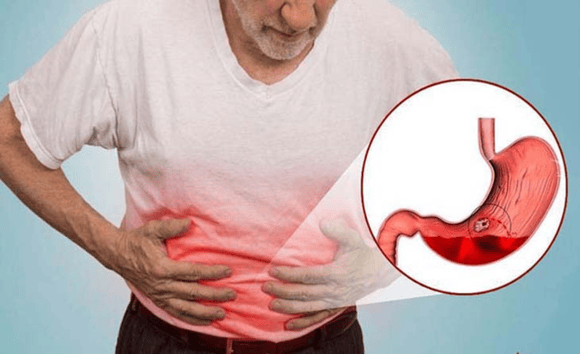 Ai dễ mắc nhiễm trùng dạ dày? Yếu tố nguy cơ thường gặp 