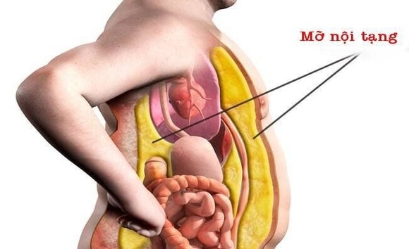 Mỡ nội tạng là gì? Hiểm họa sức khỏe ẩn sau vòng eo 