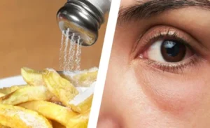 FTT_Tại sao ăn mặn buổi tối sáng hôm sau mặt lại bị sưng?