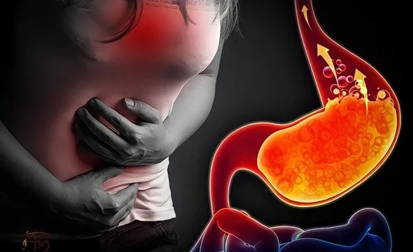 Tăng acid dịch vị: nguyên nhân, triệu chứng và cách xử lý an toàn 