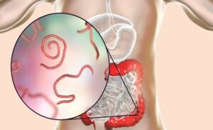 FTT_Cách phục hồi đường ruột sau khi ăn phải đồ sống bị nhiễm khuẩn