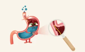 FTT_Giảm acid dịch vị: vì sao gây đầy bụng, khó tiêu và cách khắc phục