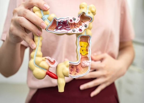 Bệnh viêm đại tràng cấp tính là gì, hiểu rõ hơn?
