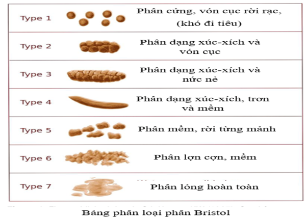 Táo bón chức năng là gì? Vì sao dễ kéo dài và tái lại?